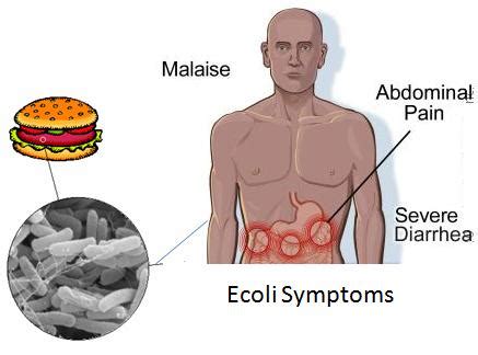 Escherichia Coli (E. Coli) Infection - Transmission, Symptoms And ...