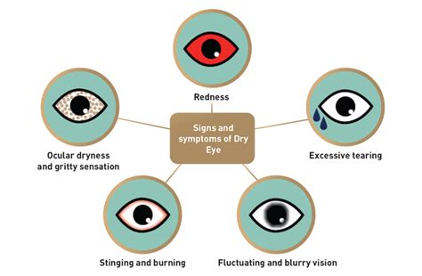 Understanding dry eye