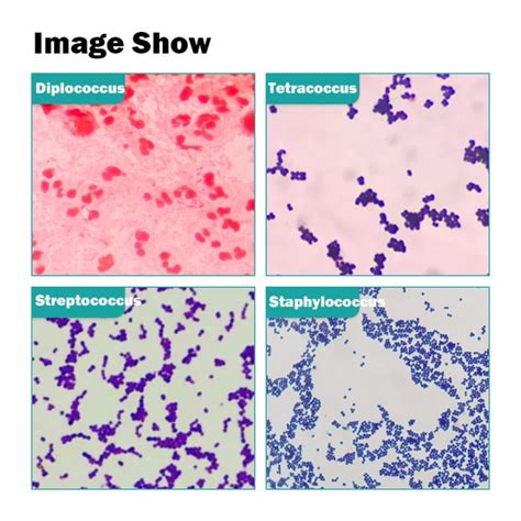 Bacteria Fungus Microscope Slides 5/10/20/25/50 Pieces Microbes ...