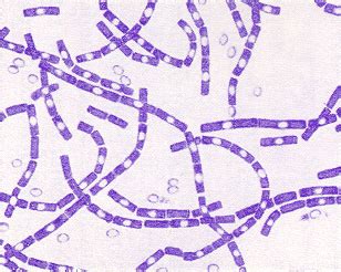 Bacillus anthracis. Causes, symptoms, treatment Bacillus anthracis