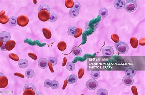 Campylobacter Jejuni Infection Illustration High-Res Vector Graphic ...