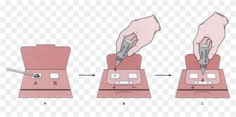 Fecal Occult Blood Test - Guaiac Fecal Occult Blood Test, HD Png ...