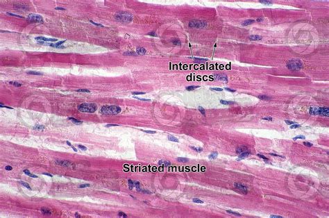 Man. Cardiac muscle. Longitudinal section. 500X - Man - Mammals ...