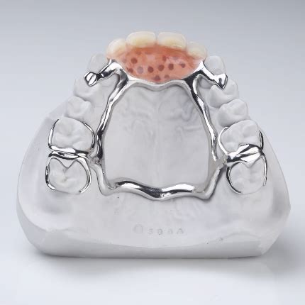 Digital Partial Dentures - Diamond Denture Studio