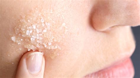 4 Steps to Getting Rid of a Cystic Pimple, Fast | Allure