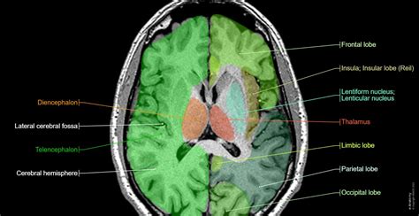 Insula Brain Anatomy