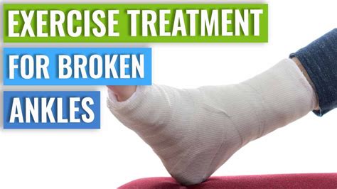 Ankle Fracture Treatment - Recovery Time & Exercises | Stroke Recovery Tips