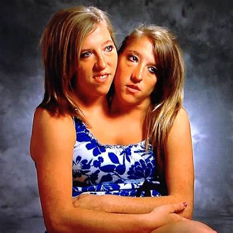 Are conjoined twins Abby and Brittany Hensel married in 2020? Tuko.co.ke