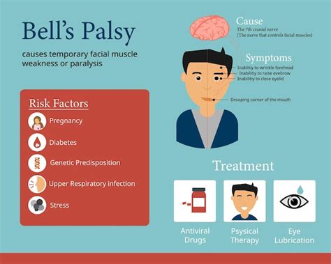 Premium Vector | Bell's palsy infographic to show the cause the symptom