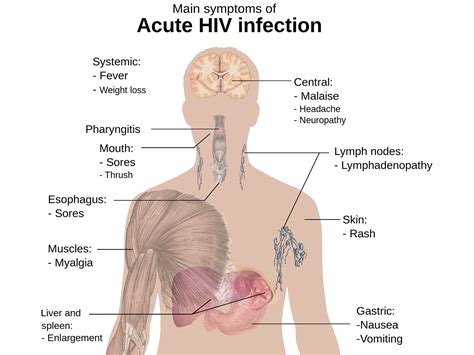 How Does HIV/AIDS Affect the Mouth?