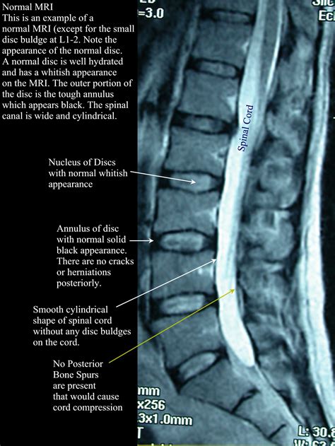 Imaging and the Lumbar Spine: What does it tell us? — AMP Healthcare ...