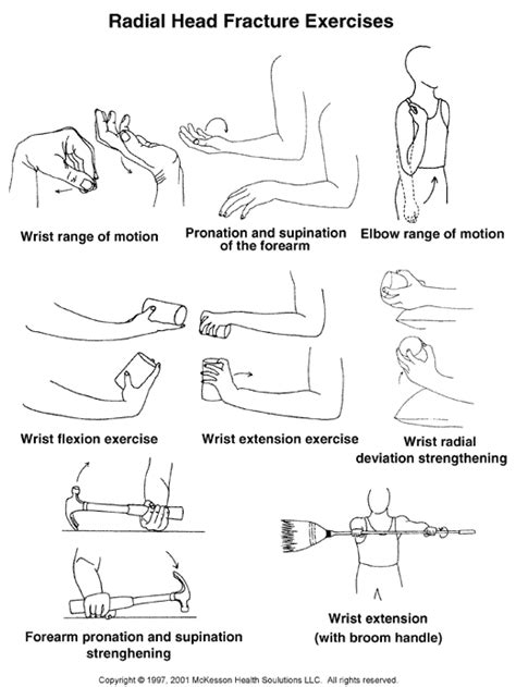 Sports Medicine Advisor 2003.1: Radial Head Fracture Rehabilitation ...