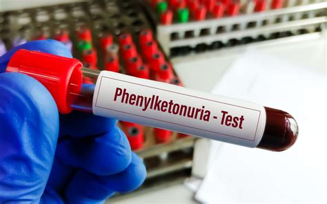 Top 7 Trends in Phenylketonuria Treatment Market