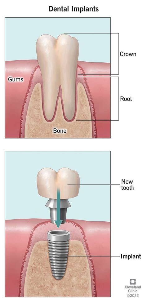 Dental Teeth Images