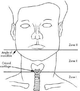 Neck Anatomical Zones for Cancer and Trauma | Surgery Blog, Calvin Lee ...