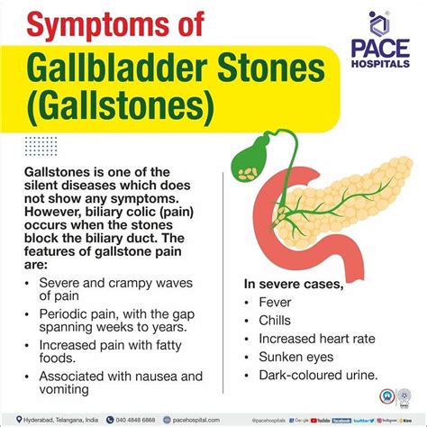 Gallstones, Gallbladder Stones – Symptoms, Causes, Complications