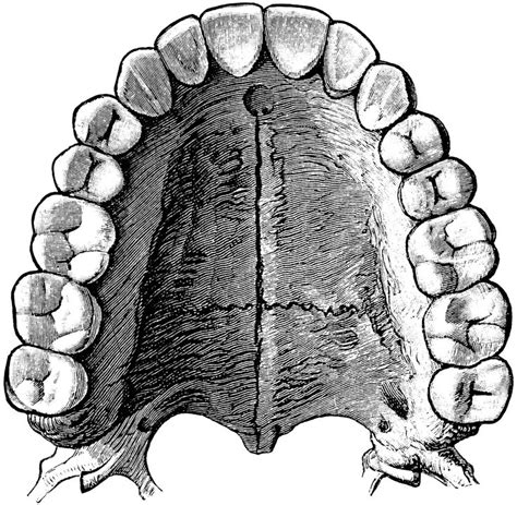 56677_teeth_lg.gif (1024×1002) | Teeth art, Dentist art, Dental anatomy