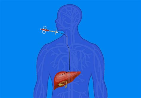 Liver Biopsy | Gastro Associates