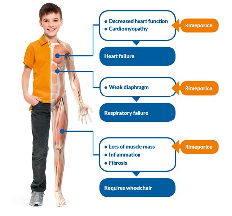 Distrofia Muscolare Di Duchenne E Atassia Sintomi Cause E Aspettative ...