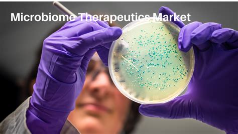 Microbiome Therapeutics Market Size, Growth and Forecast 2030