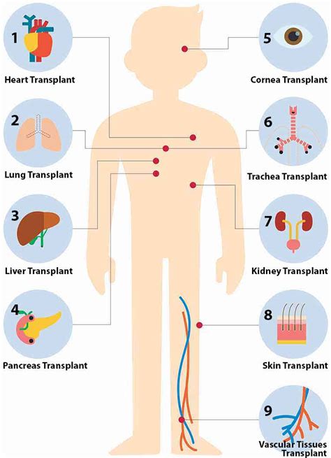 Types of Organ Transplants - HealthXchange