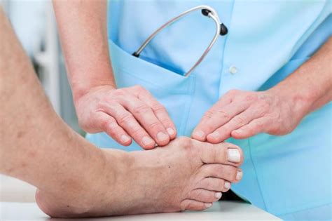 Bunions: Causes, Symptoms, and Treatment | Life Health Max