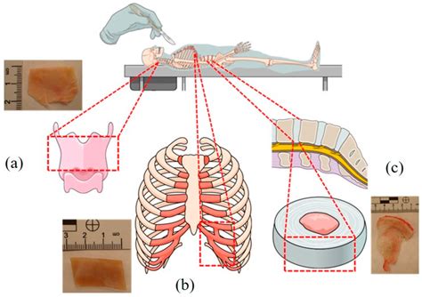 Epiglottis Cartilage, Costal Cartilage, and Intervertebral Disc ...