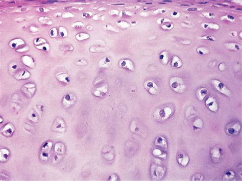 Types Of Cartilage Tissue