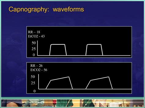 CC - EtCO2 and Waveform Capnography