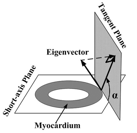 Helix angle definition. 2.2. Myocardium structure remodeling in MI ...