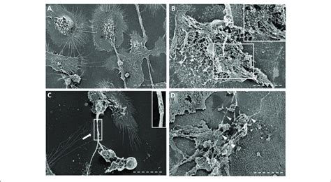 | Scanning electron microscopy images of macrophages infected with ...