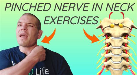 Pinched Nerve In Neck Exercises | Relieve Pinched Nerve Pain