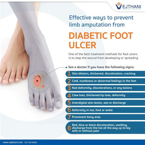 Diabetic Foot Ulcer Stages