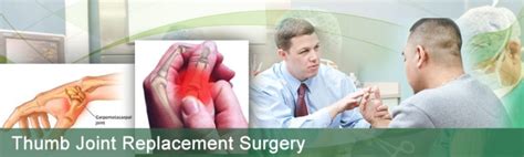 Thumb Joint Replacement Surgery in India | Thumb Arthritis