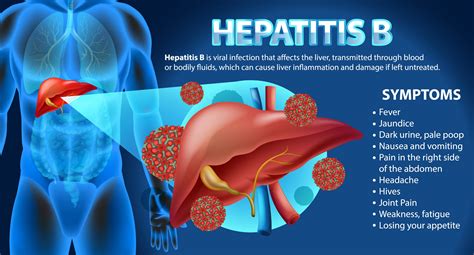 Symptoms of Hepatitis B Infographic - Library, Archive & Open Research ...