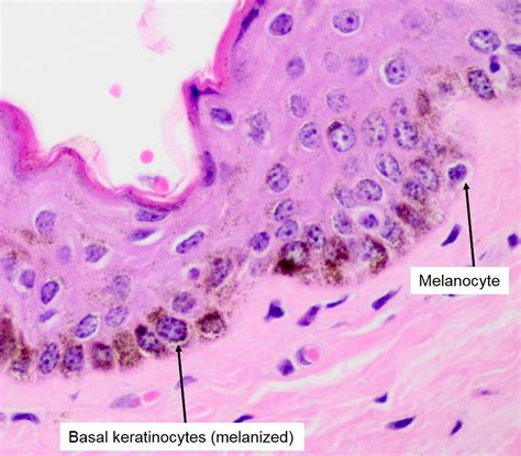 Langerhans Cells Histology