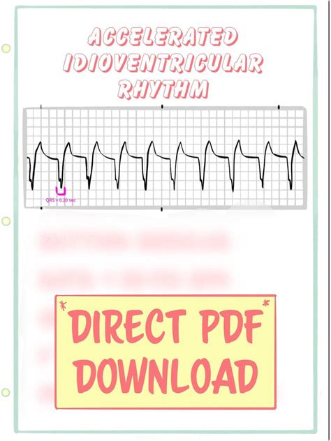 Accelerated Idioventricular Rhythm: PDF Pocket Guide - Etsy