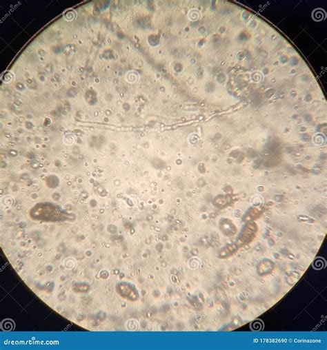 Alternaria Fungal Spores Under The Microscope Stock Image ...