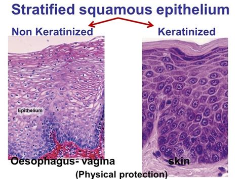 Squamous tissue in 2021 | Basic anatomy and physiology, Squamous ...