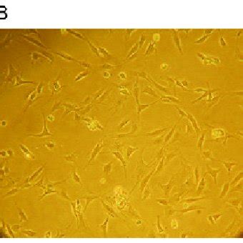 Morphology of nucleus pulposus cells in the different groups ...