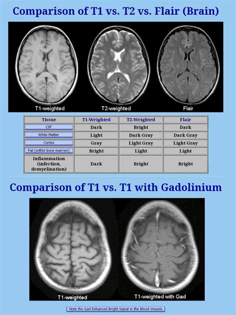 DASAR MEMBACA MRI – radiologi.id