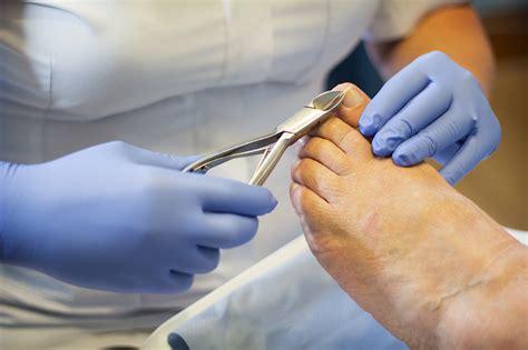 Chiropody — Happy Feet Podiatry Services | Belfast