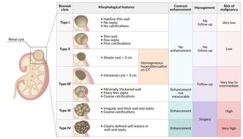 Difference Between Cyst And Tumor Features Causes