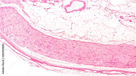 Myelinated Axon Histology