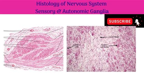 Spinal Ganglion Histology