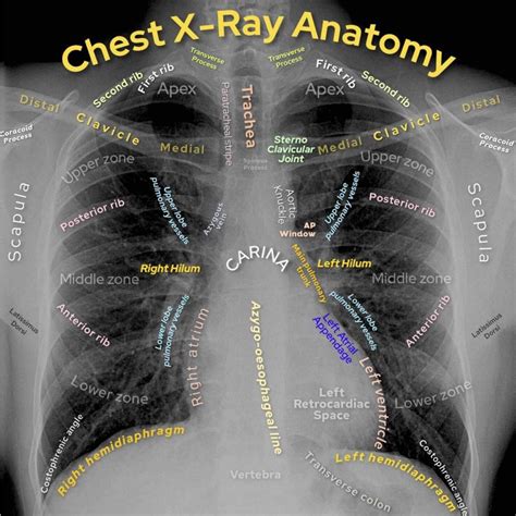 Basic Chest X-Ray Interpretation - Tips and pointers to see it all!