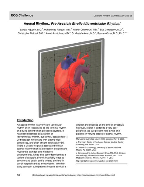 (PDF) Agonal Rhythm.. Pre-Asystole Erratic Idioventricular Rhythm!