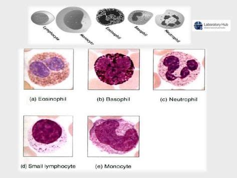 10+ Hematology Slides ideas in 2020 | hematology, medical lab ...