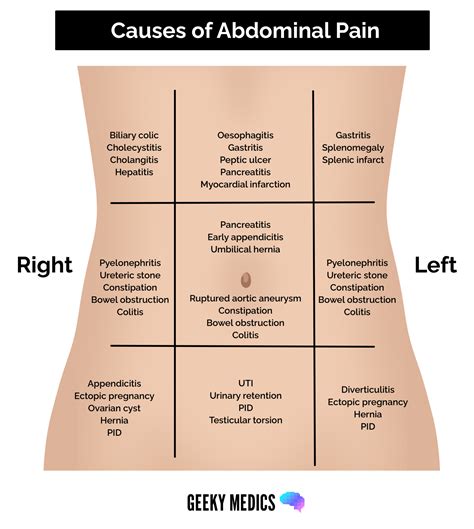 Causes Of Upper Abdominal Pain – NBKomputer