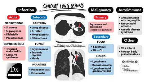 Dx schema – Lung Cavity – The Clinical Problem Solvers